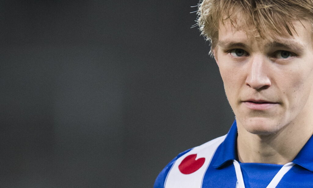 Ødegaard om norsk brøler: - Det var sjokkerende