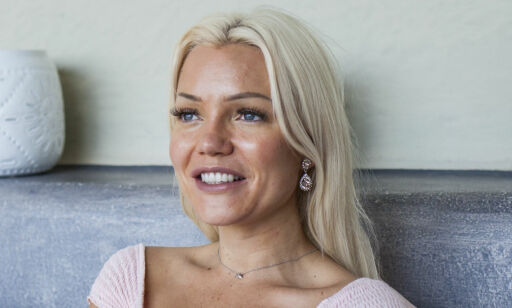 «Paradise»-profilen åpen om de plastiske operasjonene: - Viktig å være ærlig