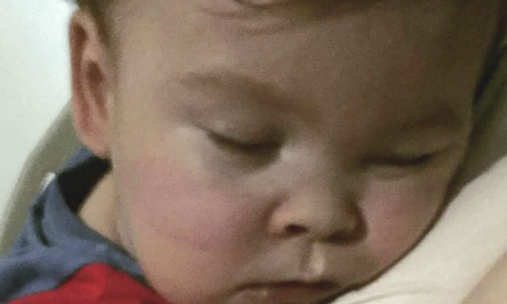 Slik var foreldrenes kamp for å holde Alfie (2) i live